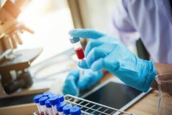 lab technician assistant analyzing a blood sample in test tube at laboratory.