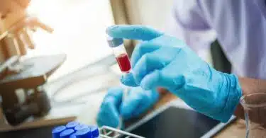 lab technician assistant analyzing a blood sample in test tube at laboratory.