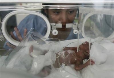 23 Weeker Defies Odds By Breathing Just One Week After Birth
