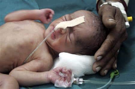 Indian Baby survives Railway Track Birth