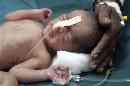 Indian Baby survives Railway Track Birth
