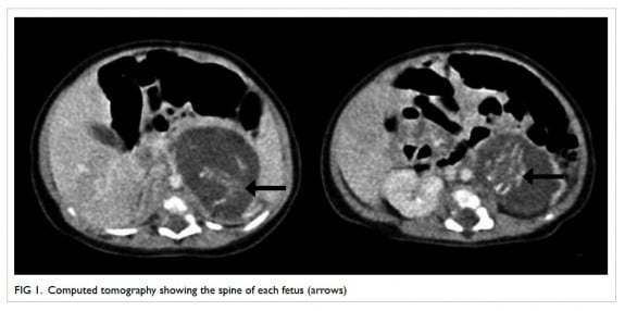 Image Via Hong Kong Medical Journal