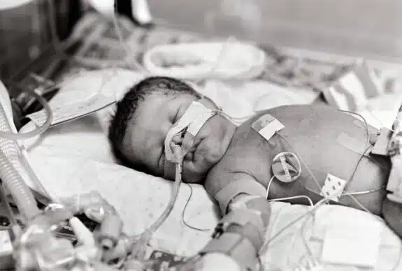 premature baby boy