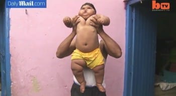 10 month old Aliya Saleem weighs 40lbs