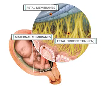 baby uterus