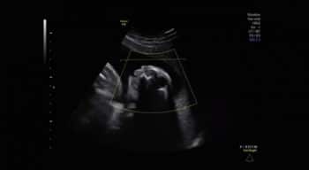 Jess Evans's ultrasound