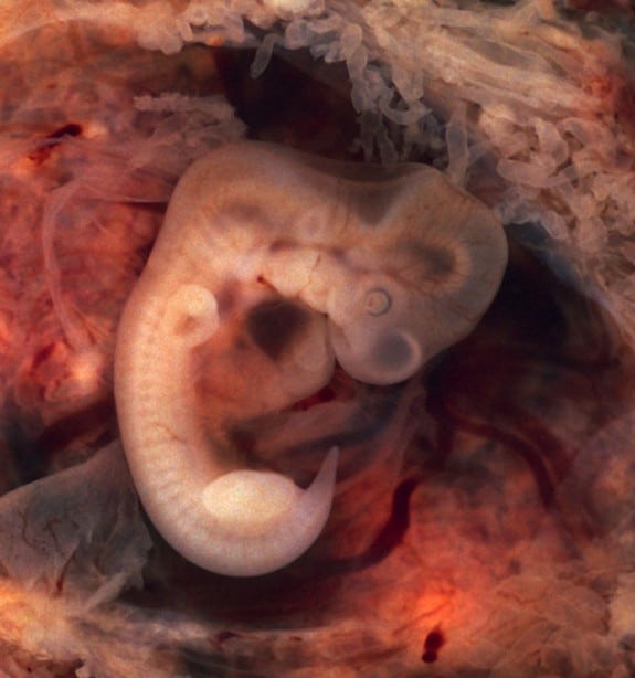 4 week fetus