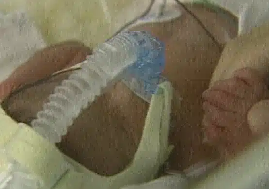 One of the remaining Soldani sextplets