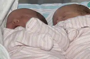 Record Breaking Twins Born In Alabama