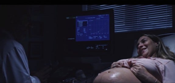 Tatiana Guerra - ultrasound