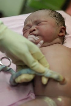 newborn umbilical cord
