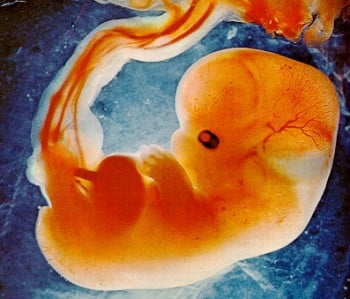 7+week fetus
