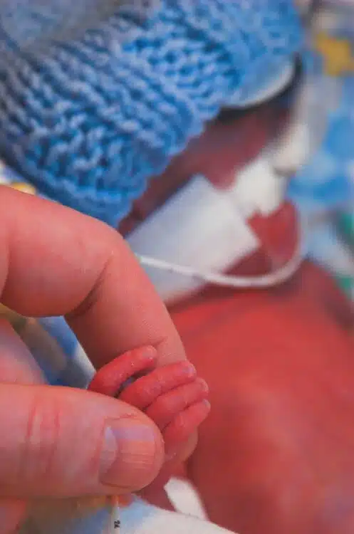 preemie