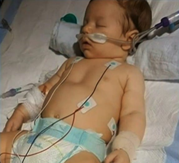 Baby struck with Botulism -Benjamin Shell