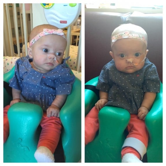 Twins with cancer Kenedi and Kendal Breyfogle