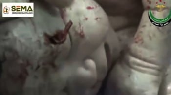 Unborn Syrian baby, mother injured by shrapnel saved by doctors