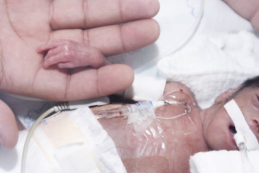 tiny preemie