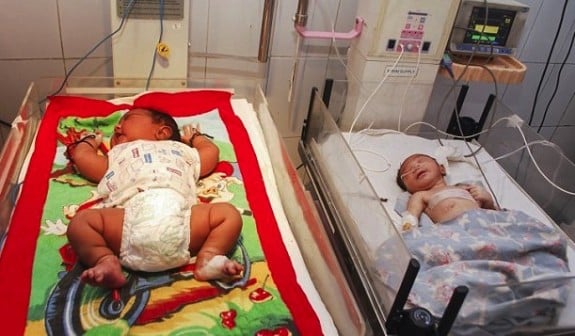 13lb baby born in india