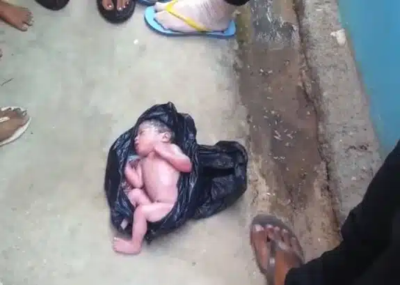 Newborn Baby Discarded in Garbage Bag rescued By Passersby