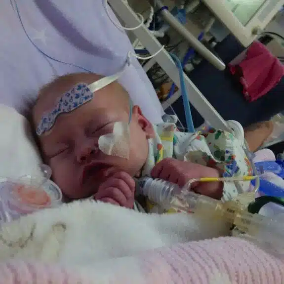 Ruby Callaghan hours before her life-saving heart transplant