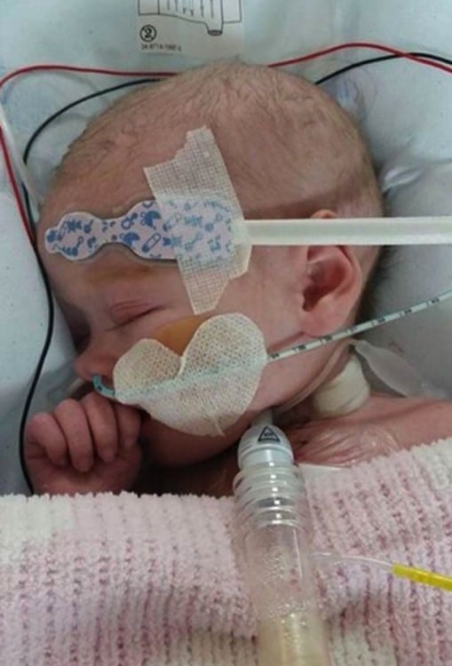 Ruby Callaghan hours before her life-saving heart transplant