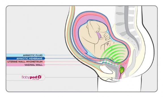 Babypod image of baby listening to music through the vagina