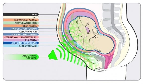 Babypod image of music being delivered to baby with a headphone