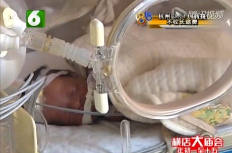 Preemie, Who Was Declared Dead, Comes Back To Life Before Cremation