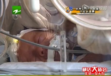 Preemie, Who Was Declared Dead, Comes Back To Life Before Cremation