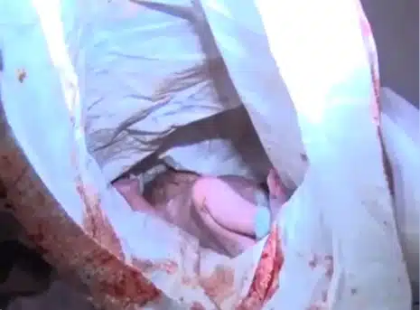 Abandoned Newborn Rescued From Outdoor Toilet