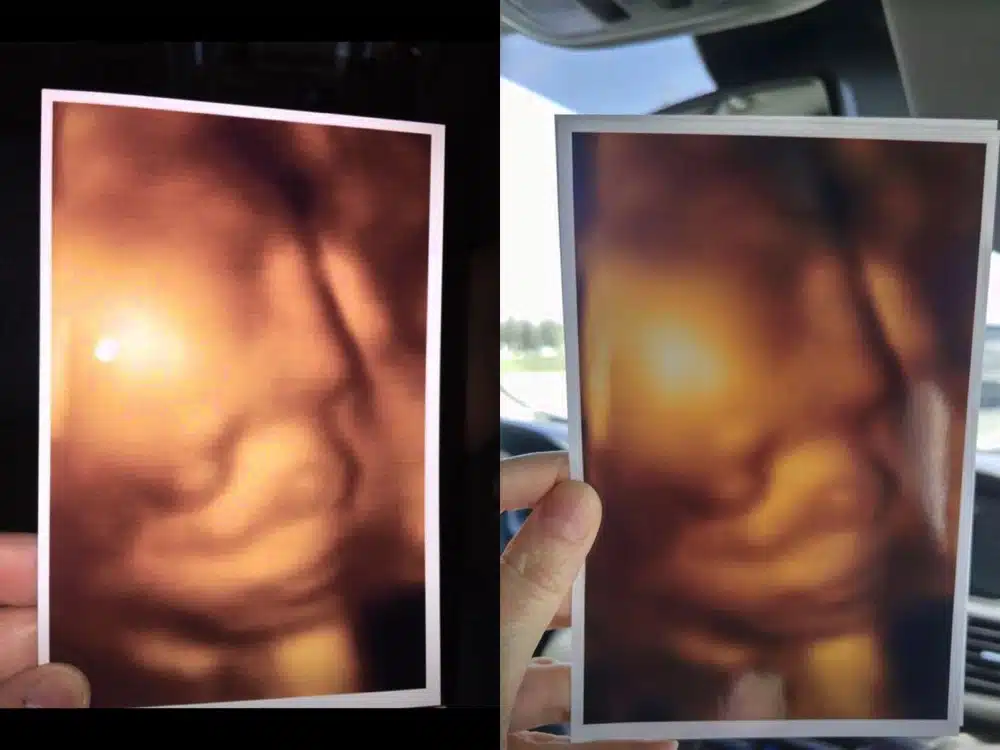 Jenn Cusimano's 3d ultrasound picture