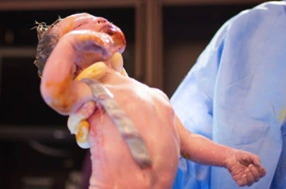 Lisa Robinson captures her own childbirth