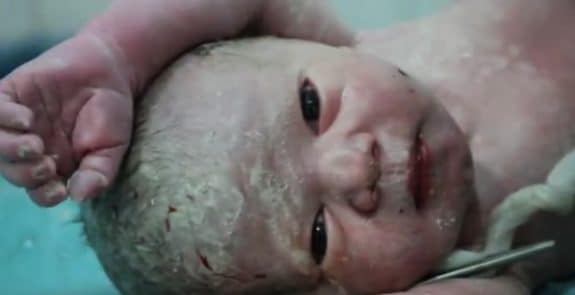 doctors revive baby born in a Syria bombing