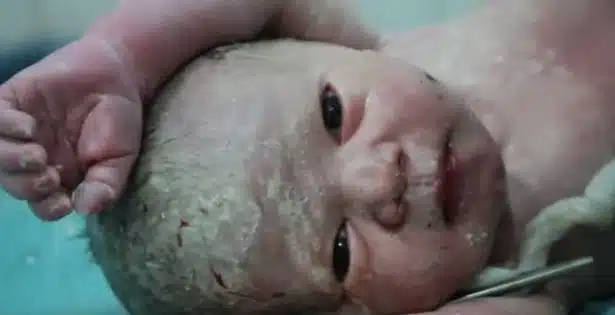 doctors revive baby born in a Syria bombing