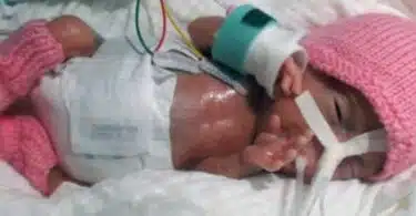 worlds-tiniest-baby-emilia
