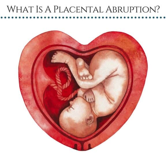 What Is A Placental Abruption