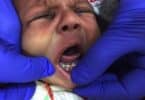 baby born with seven teeth