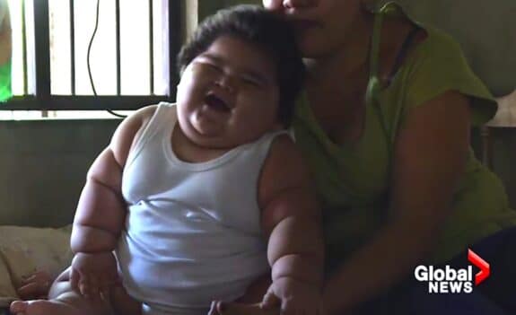 62 pound mexican baby Luis Manuel Gonzales