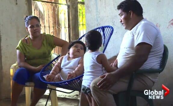 62 pound mexican baby Luis Manuel Gonzales with his family