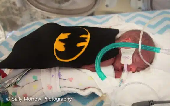Baby-Hurtado-in-a-batman-costume-NICU-Saint-Luke’s-Hospital-Kansas-City-March-of-Dime