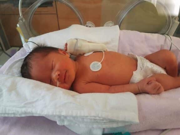 Eiko Crisostomo Canada's first in-utero spina bifida baby