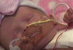 Baby Vanellope born with ectopia cordis at Glenfield Hospital in Leicester