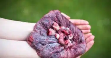Do Placenta Capsules Offer Postpartum Benefits for New Moms?jpeg