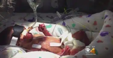Tiny preemie Cayden