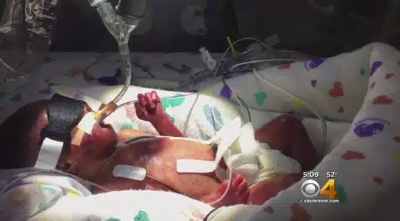 Tiny preemie Cayden