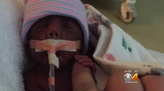 Tiny preemie Cayden