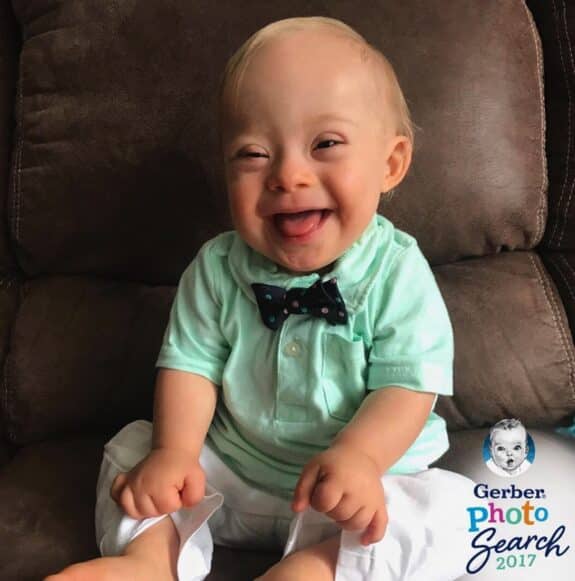 Toddler with Down Syndrome Lucas Warren gerber baby 2018