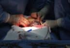 Second U.S. Baby Born VIA Transplanted Uterus