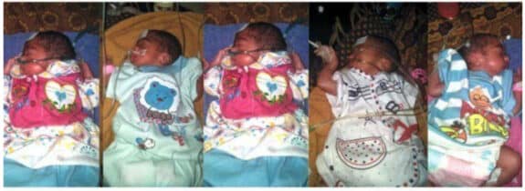 Pakistani Mom Welcomes Sextuplets