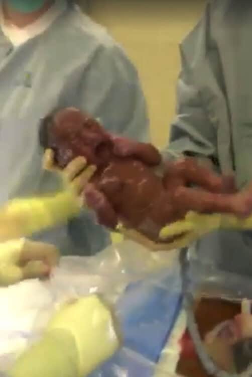 INCREDIBLE En-Caul Birth Captured On Camera!